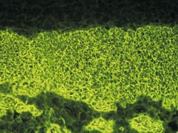 Ifa Immunofluorescenza EMA